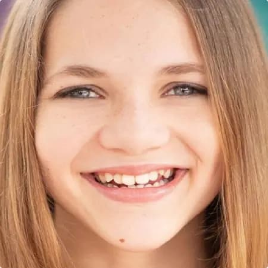 invisalign before.